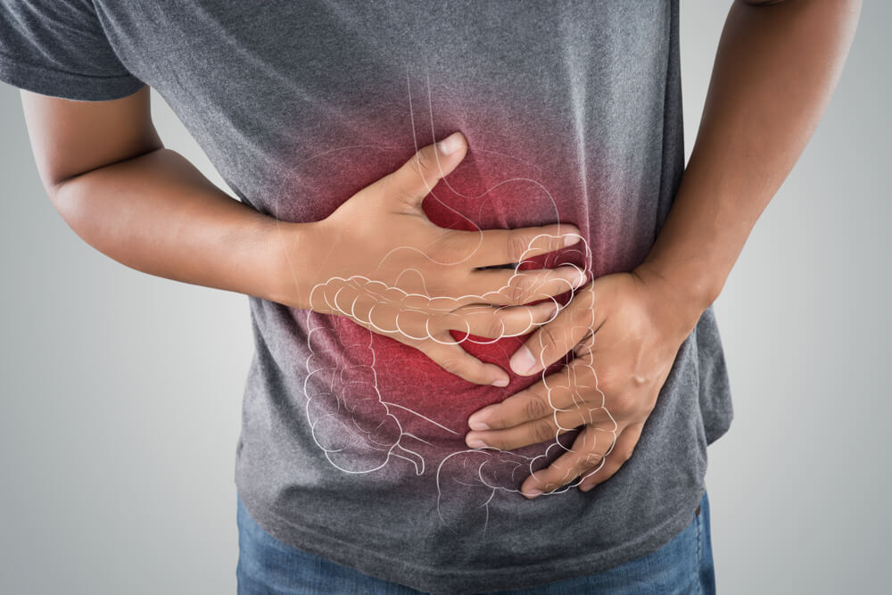 Natural Remedies for Ulcerative Colitis