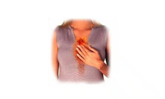 Acid Reflux Signs and Symptoms