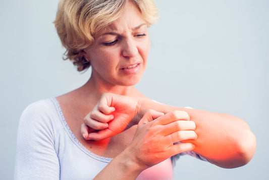 How can I reduce the inflammation of eczema?